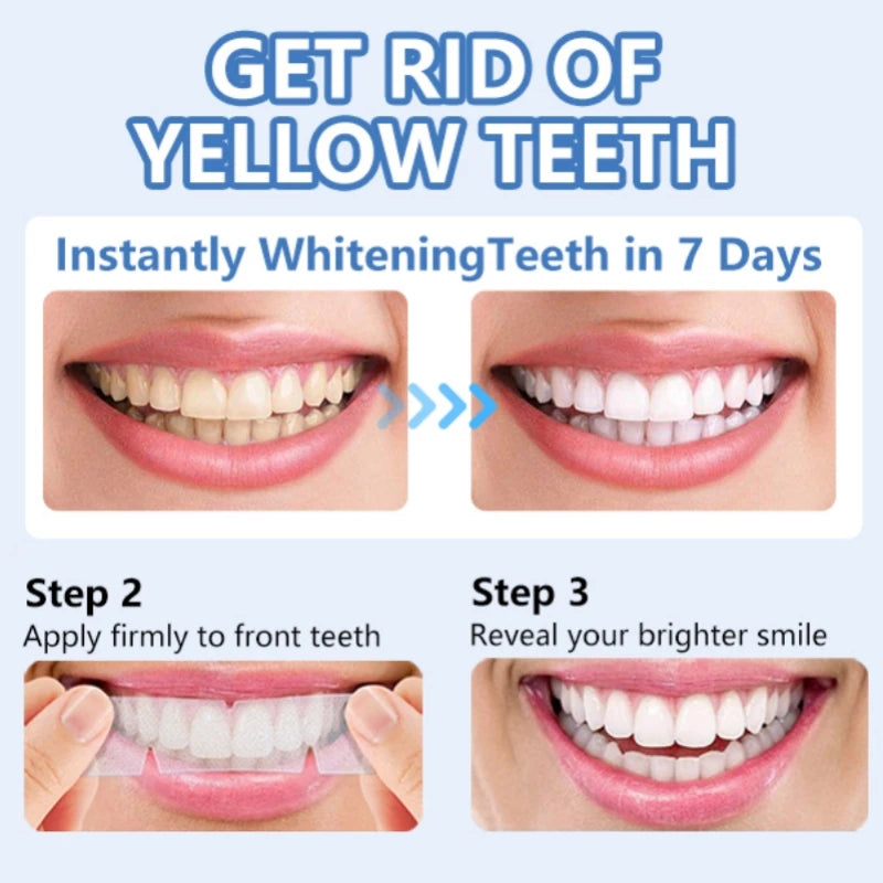 5D Teeth Whitening Strips  (28pairs)